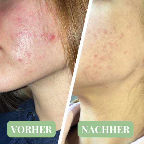 Hemptouch - Harmonisierende CBD Gesichtscreme